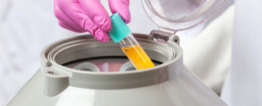 Platelet-Rich Plasma Mount Vernon, WA
