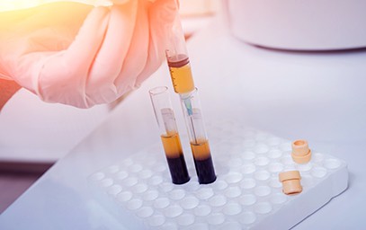 PRP Injections Bellingham, WA