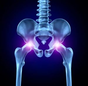 Non-Surgical Hip Pain Treatment Bellingham, WA