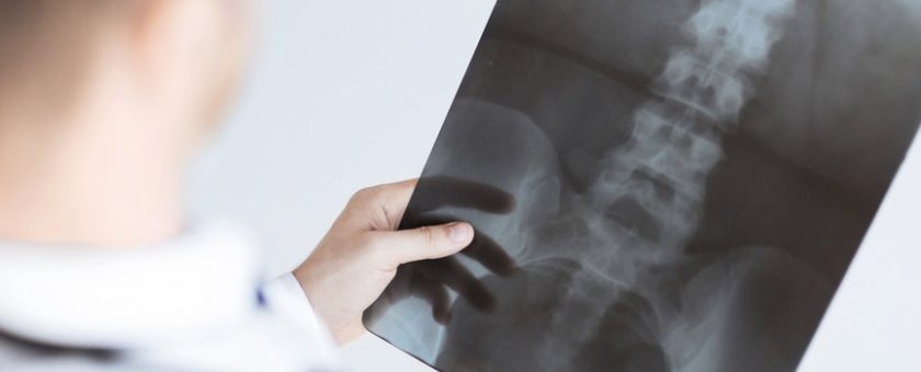 Spine and Extremity X-rays Mount Vernon, WA